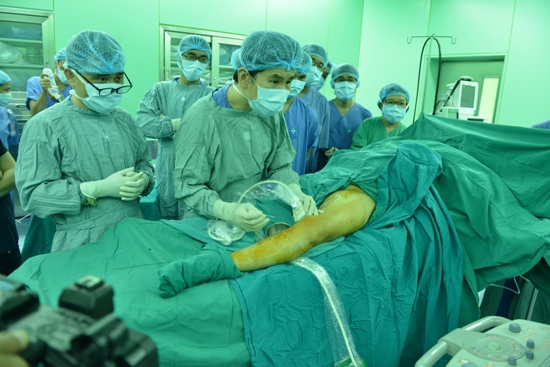 Phương pháp mới điều trị bệnh suy giãn tĩnh mạch nông chi dưới ảnh 1